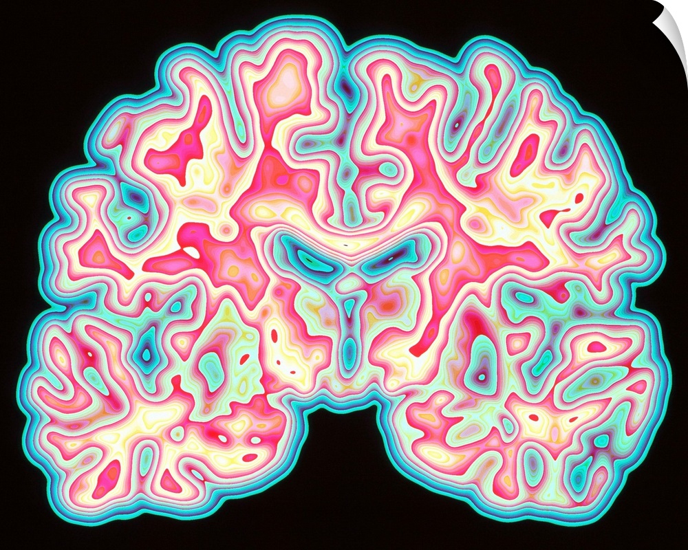 Wall Decal entitled CT scan of brain Wall Decal entitled CT scan of brain