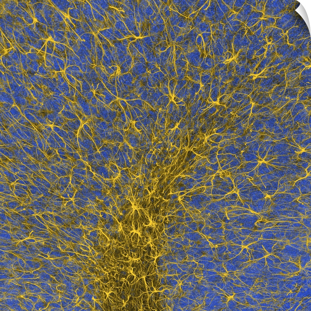 Wall Decal entitled Glial cells, confocal light micrograph Wall Decal entitled Glial cells, confocal light micrograph